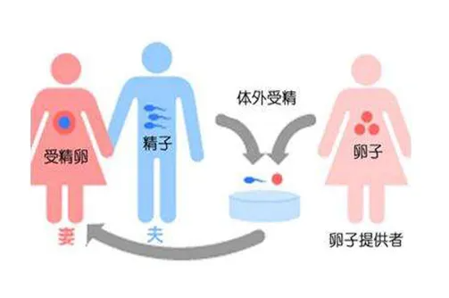 扬州合法供卵成功率-严重卵巢早衰用供卵试管婴儿的成功率高吗？为什么捐卵试管婴儿的成功率高？(图1)